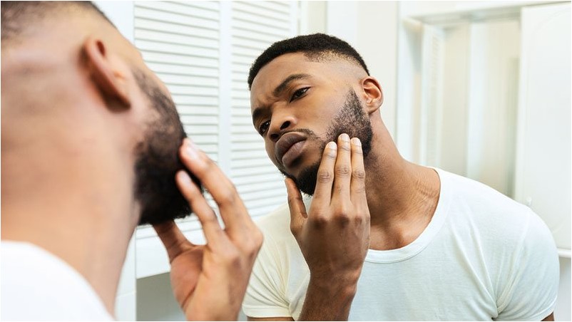 Как нанести миноксидил на бороду