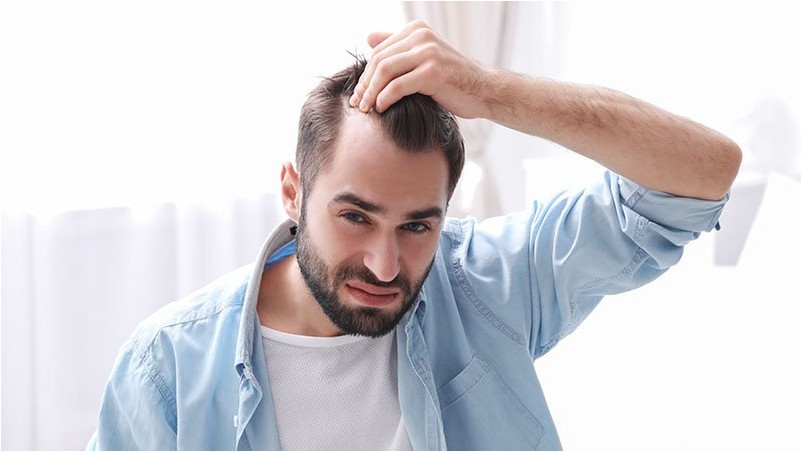 Молодой человек с проблемой выпадения волос в помещении